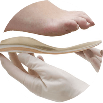 Custom orthotics fitting